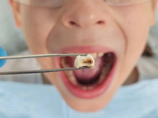 Best Emergency Dentist for Special Needs Patients in Daniels Farm, CT
